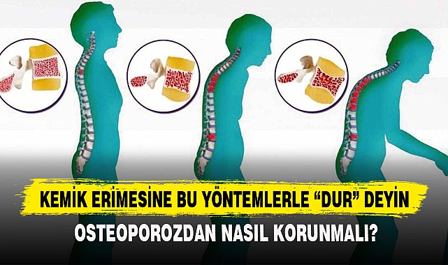 KEMİK ERİMESİNE BU YÖNTEMLERLE "DUR" DEYİN