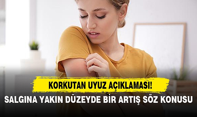 KORKUTAN UYUZ AÇIKLAMASI: "SALGINA YAKIN DÜZEYDE BİR ARTIŞ SÖZ KONUSU"