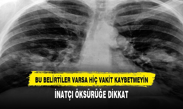 Akciğer kanserinin 10 önemli sinyali: İnatçı öksürük de alarm olabilir