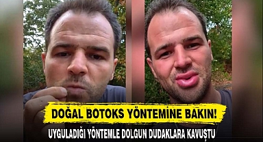 DOĞAL BOTOKS YÖNTEMİNE BAKIN!