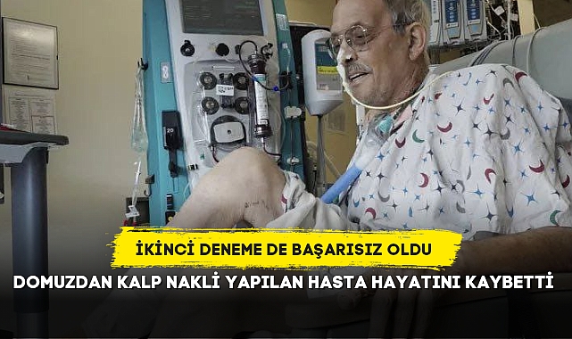 DOMUZDAN KALP NAKLİ YAPILAN HASTA HAYATINI KAYBETTİ
