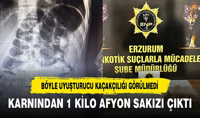 KARNINDAN 1 KİLO AFYON SAKIZI ÇIKTI
