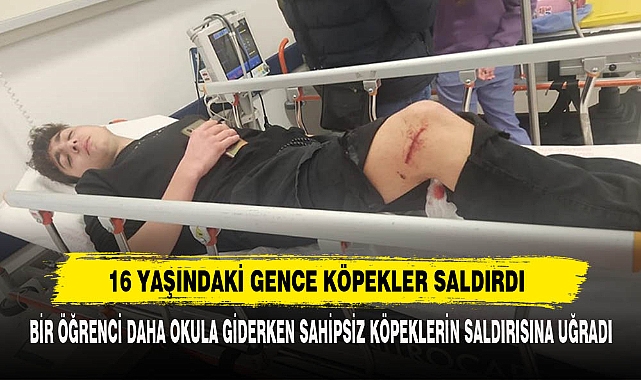 16 Yaşındaki Gence Köpekler Saldırdı