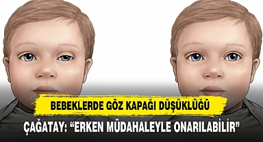 Bebeklerde Göz Kapağı Düşüklüğü