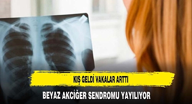 BEYAZ AKCİĞER SENDROMU VAKALARI ARTIYOR