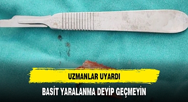 Uzmanlar uyardı: Basit yaralanma demeyin!