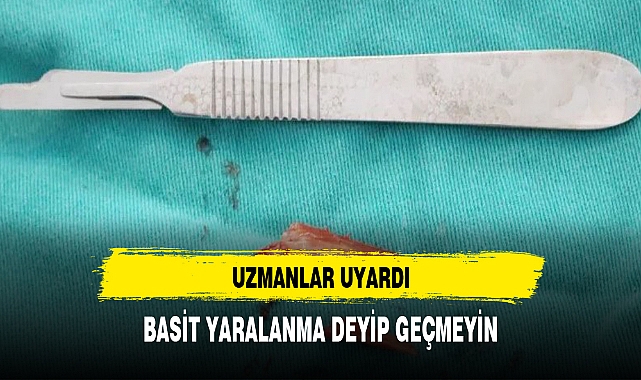 Uzmanlar uyardı: Basit yaralanma demeyin!
