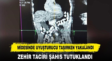 Midesinde Uyuşturucu Taşırken Yakalandı