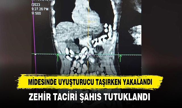 Midesinde Uyuşturucu Taşırken Yakalandı