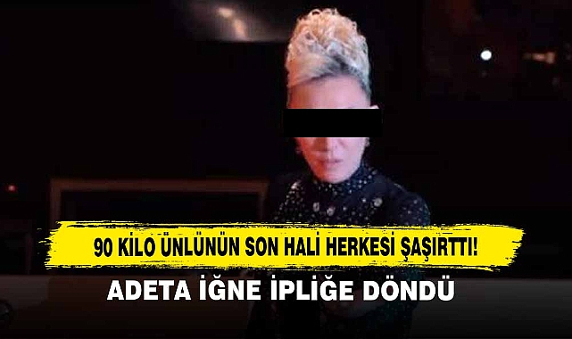 90 Kilo Ünlünün Son Hali Herkesi Şaşırttı!