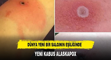 DÜNYA YENİ BİR SALGIN'IN EŞİĞİNDE BU KEZ FARELER BAŞ ROLDE