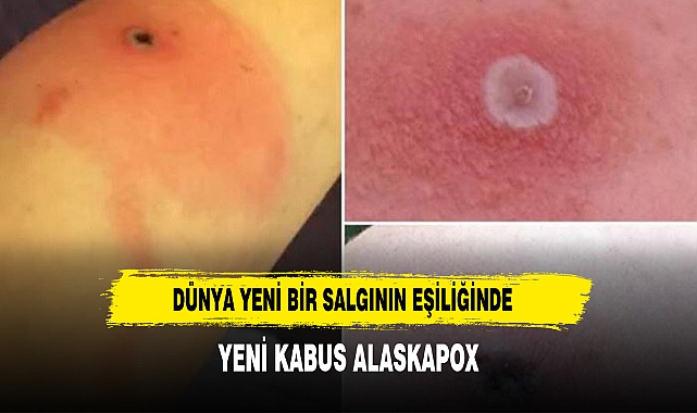 DÜNYA YENİ BİR SALGIN'IN EŞİĞİNDE BU KEZ FARELER BAŞ ROLDE