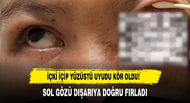 İçki İçip Yüzüstü Uyudu Kör Oldu!