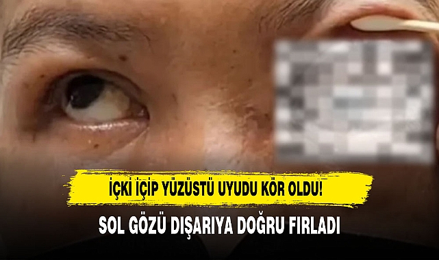 İçki İçip Yüzüstü Uyudu Kör Oldu!