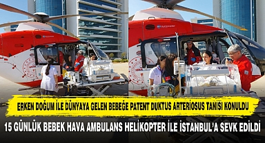 Erken Doğum ile Dünyaya Gelen Bebeğe Patent Duktus Arteriosus Tanısı Konuldu