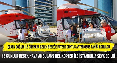 Erken Doğum ile Dünyaya Gelen Bebeğe Patent Duktus Arteriosus Tanısı Konuldu