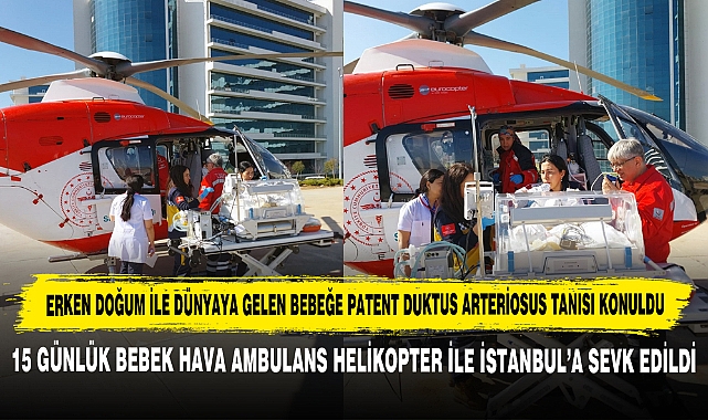 Erken Doğum ile Dünyaya Gelen Bebeğe Patent Duktus Arteriosus Tanısı Konuldu