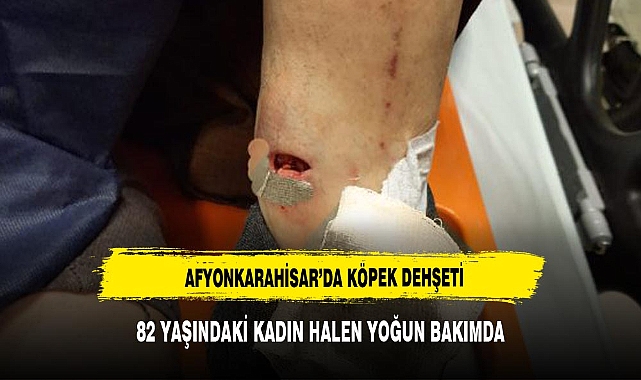 AFYON'DA 82 YAŞINDAKİ KADINI KÖPEK ISIRDI YOĞUN BAKIMA ALINDI