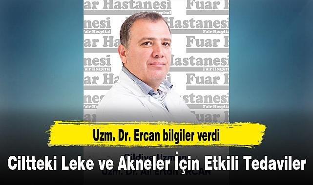 Ciltteki Leke ve Akneler İçin Etkili Tedaviler