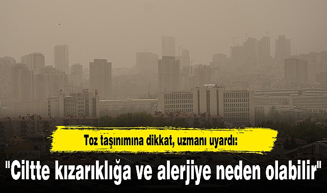 Toz taşınımına dikkat, uzmanı uyardı: "Ciltte kızarıklığa ve alerjiye neden olabilir"