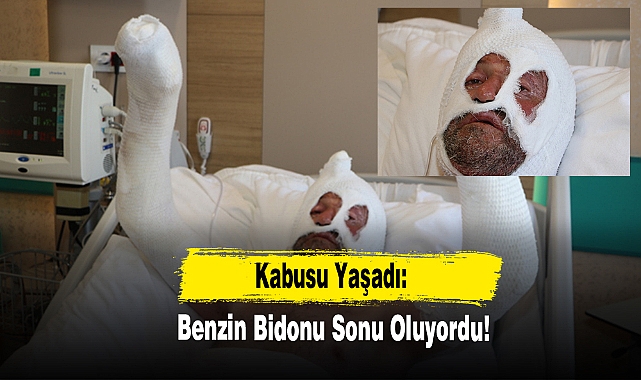 Kâbusu Yaşadı:  Benzin Bidonu Sonu Oluyordu!