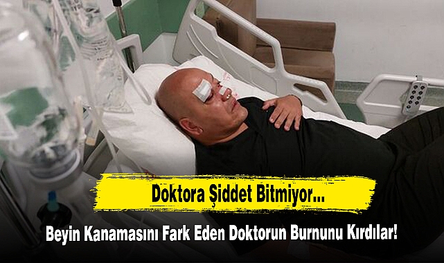 Doktora Şiddet Bitmiyor! Beyin Kanamasını Fark Eden Doktorun Burnunu Kırdılar!