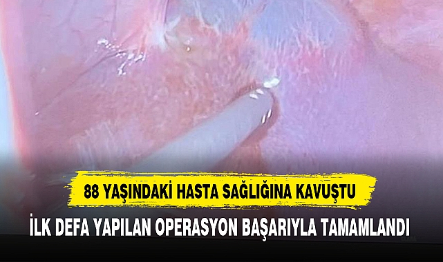 88 YAŞINDAKİ HASTA SAĞLIĞINA KAVUŞTU