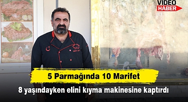 5 Parmağında 10 Marifet! 8 yaşındayken elini kıyma makinesine kaptırdı
