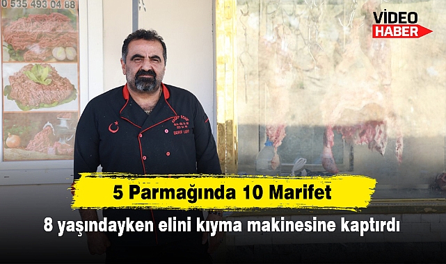 5 Parmağında 10 Marifet! 8 yaşındayken elini kıyma makinesine kaptırdı