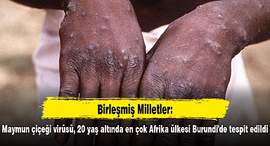 BM: Maymun çiçeği virüsü, 20 yaş altında en çok Afrika ülkesi Burundi'de tespit edildi