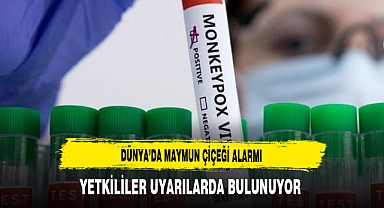 Dünya’da Maymun Çiçeği Alarmı Yetkililer Uyarılarda Bulunuyor