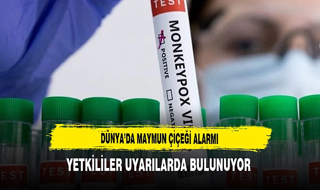 Dünya’da Maymun Çiçeği Alarmı Yetkililer Uyarılarda Bulunuyor
