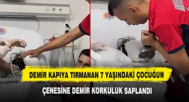 Feci Olay: 7 Yaşındaki Çocuğun Çenesine Demir Korkuluk Saplandı