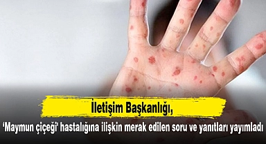İletişim Başkanlığı, 'maymun çiçeği' hastalığına ilişkin merak edilen soru ve yanıtları yayımladı