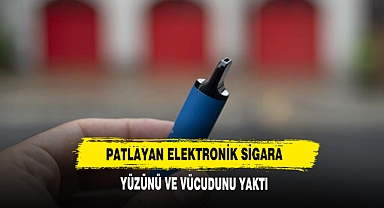 Patlayan Elektronik Sigara Yüzünü Ve Vücudunu Yaktı