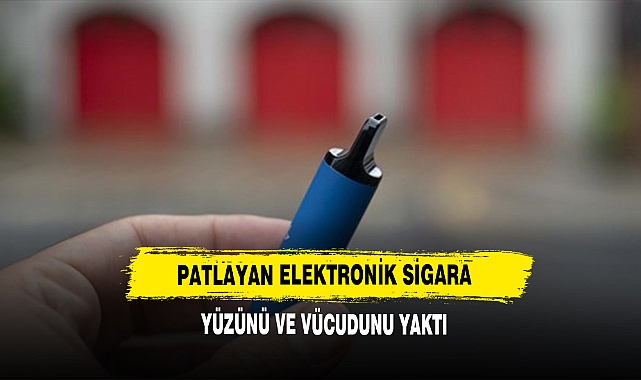 Patlayan Elektronik Sigara Yüzünü Ve Vücudunu Yaktı