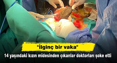 14 yaşındaki kızın midesinden çıkanlar doktorları şoke etti