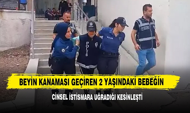Beyin Kanaması Geçiren 2 Yaşındaki Bebeğin cinsel İstismara Uğradığı Kesinleşti