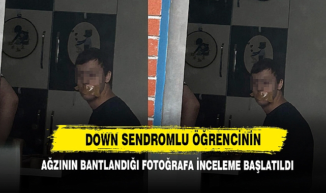 Down Sendromlu Öğrencinin Ağzının Bantlandığı Fotoğrafa İnceleme Başlatıldı