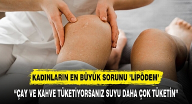 KADINLARIN EN BÜYÜK SORUNU ’LİPÖDEM’