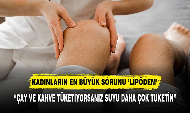 KADINLARIN EN BÜYÜK SORUNU ’LİPÖDEM’