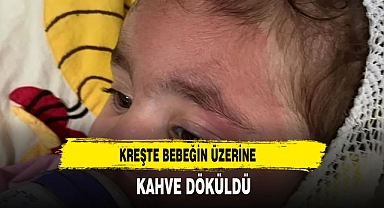 KREŞTE BEBEĞİN ÜZERİNE KAHVE DÖKÜLDÜ