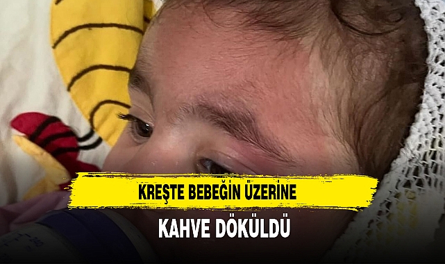 KREŞTE BEBEĞİN ÜZERİNE KAHVE DÖKÜLDÜ