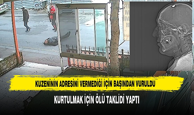 Başından Vuruldu, Kurtulmak İçin Ölü Taklidi Yaptı