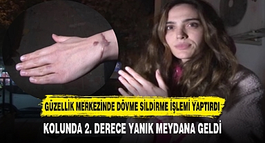 KOLUNDA 2. DERECE YANIK MEYDANA GELDİ