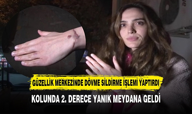 KOLUNDA 2. DERECE YANIK MEYDANA GELDİ