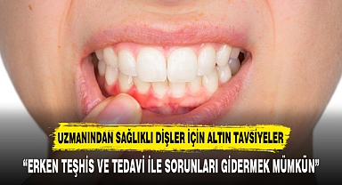 UZMANINDAN SAĞLIKLI DİŞLER İÇİN ALTIN TAVSİYELER