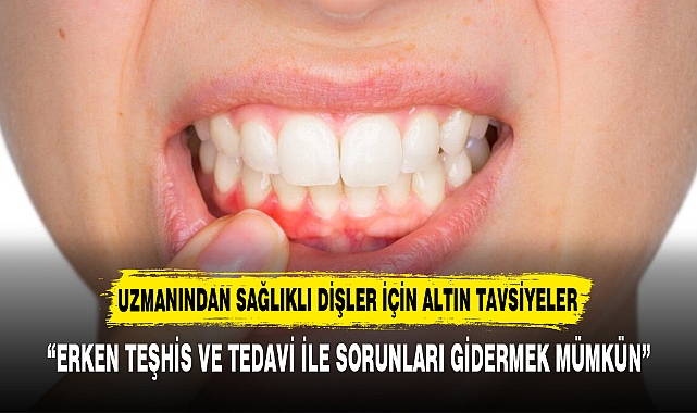 UZMANINDAN SAĞLIKLI DİŞLER İÇİN ALTIN TAVSİYELER