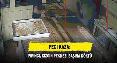 Feci Kaza: Fırıncı, Kızgın Pekmezi Başına Döktü