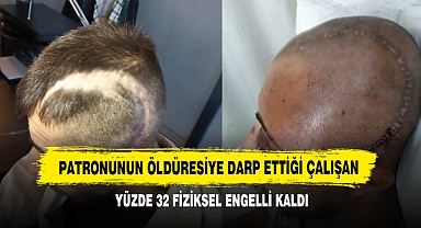 Patronunun Öldüresiye Darp Ettiği Çalışan Yüzde 32 Fiziksel Engelli Kaldı